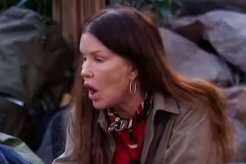 JANICE DICKINSON SUES ITV OVER I’M A CELEBRITY INJURY