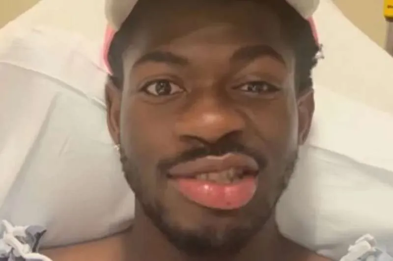 Lil Nas X Hospitalised After Health Scare Leaves Him with Facial Paralysis Lil Nas X Hospitalised After Health Scare Leaves Him with Facial Paralysis